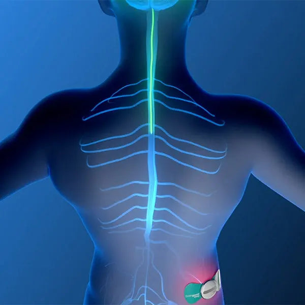 Illustration of TENS therapy relieving lower back pain
